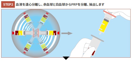 分離・抽出