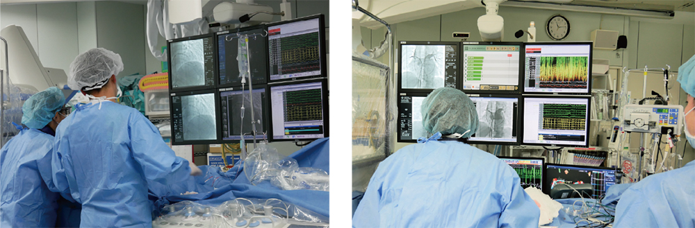 写真左：カテーテル治療中の吉野医師　写真右：上野医師によるアブレーション治療の様子