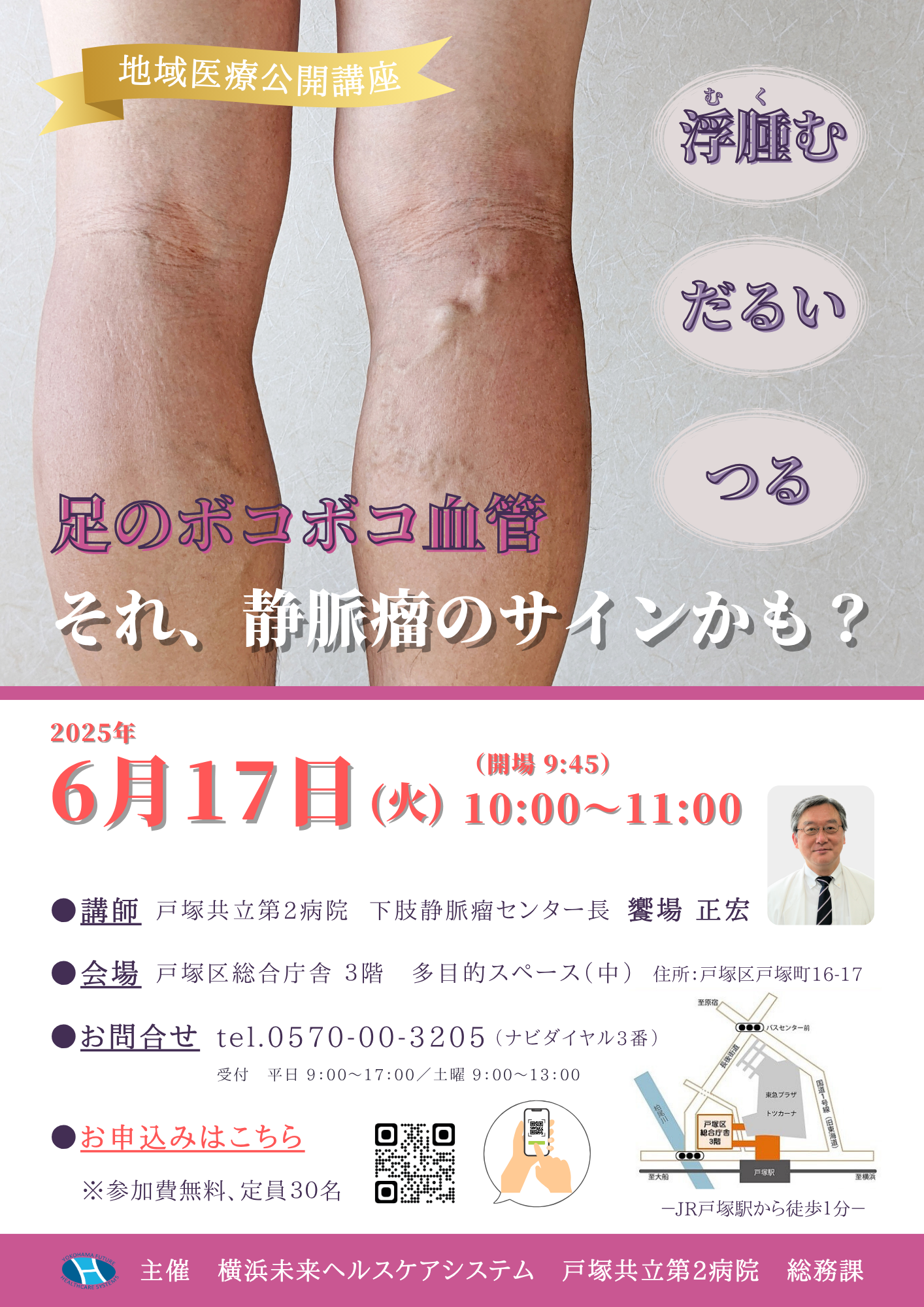 下肢静脈瘤、足のボコボコ血管・浮腫む・だるい・つる